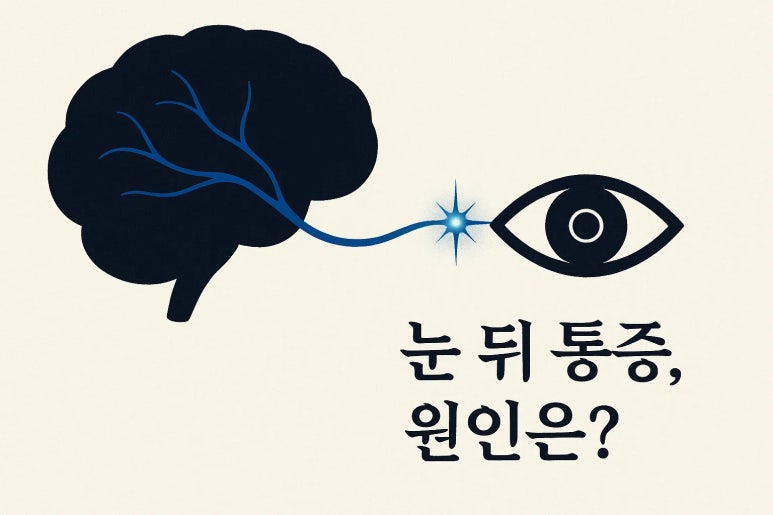 눈 뒤가 지끈거릴 때, 안과에 가야 할까 신경과에 가야 할까?