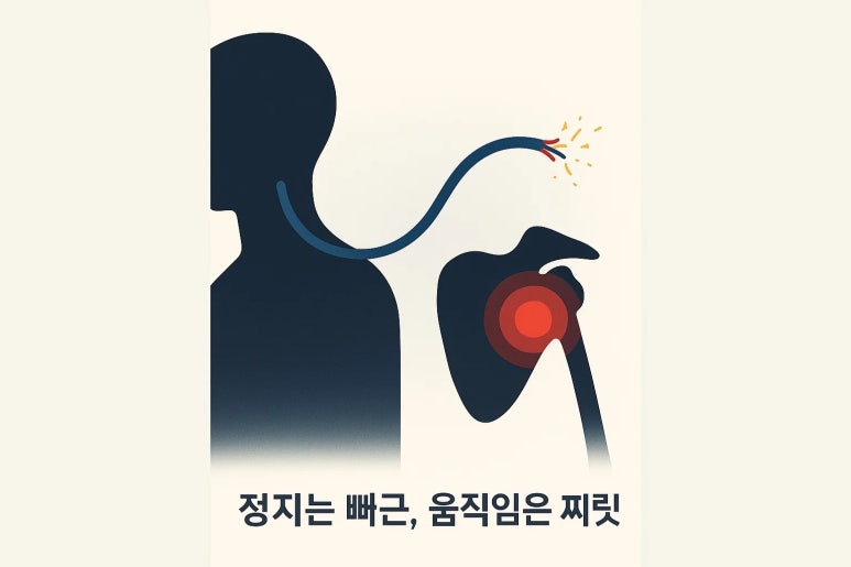목뒤 뻐근함 왜 자꾸 되돌아올까 | 인천 만성 경항통