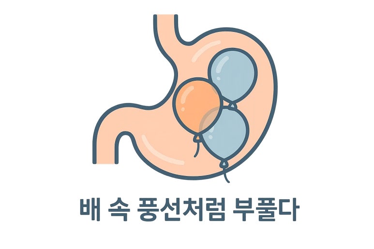 배에 가스가 자주 차는 진짜 이유