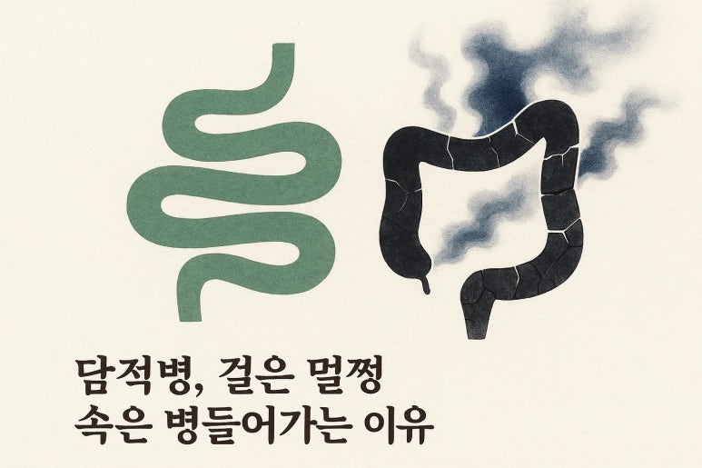 담적병 완치? 치료방법이 궁금하다면