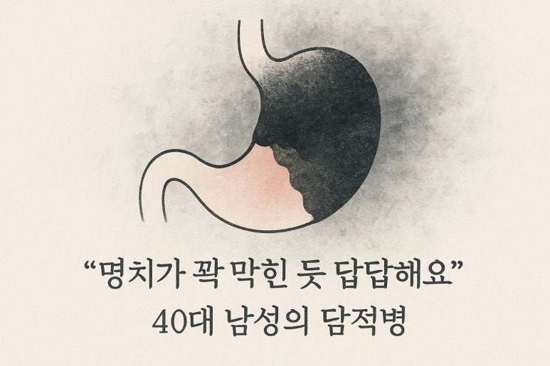 담적병 한약 “명치가 꽉 막힌 듯 답답해요” | 인천 40대 담적병