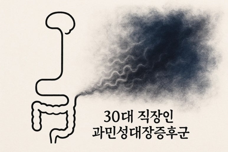 과민성 대장증후군 점액 변을 본다면?